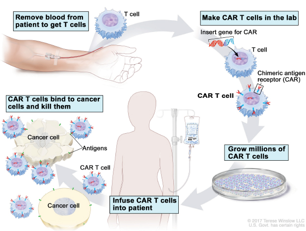 Weighing The Cost And Value Of Car T Cell Therapy The Asco Post