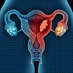 Immunotherapy and novel targeted drug appear to be beneficial in women with early-stage gynecological diseases