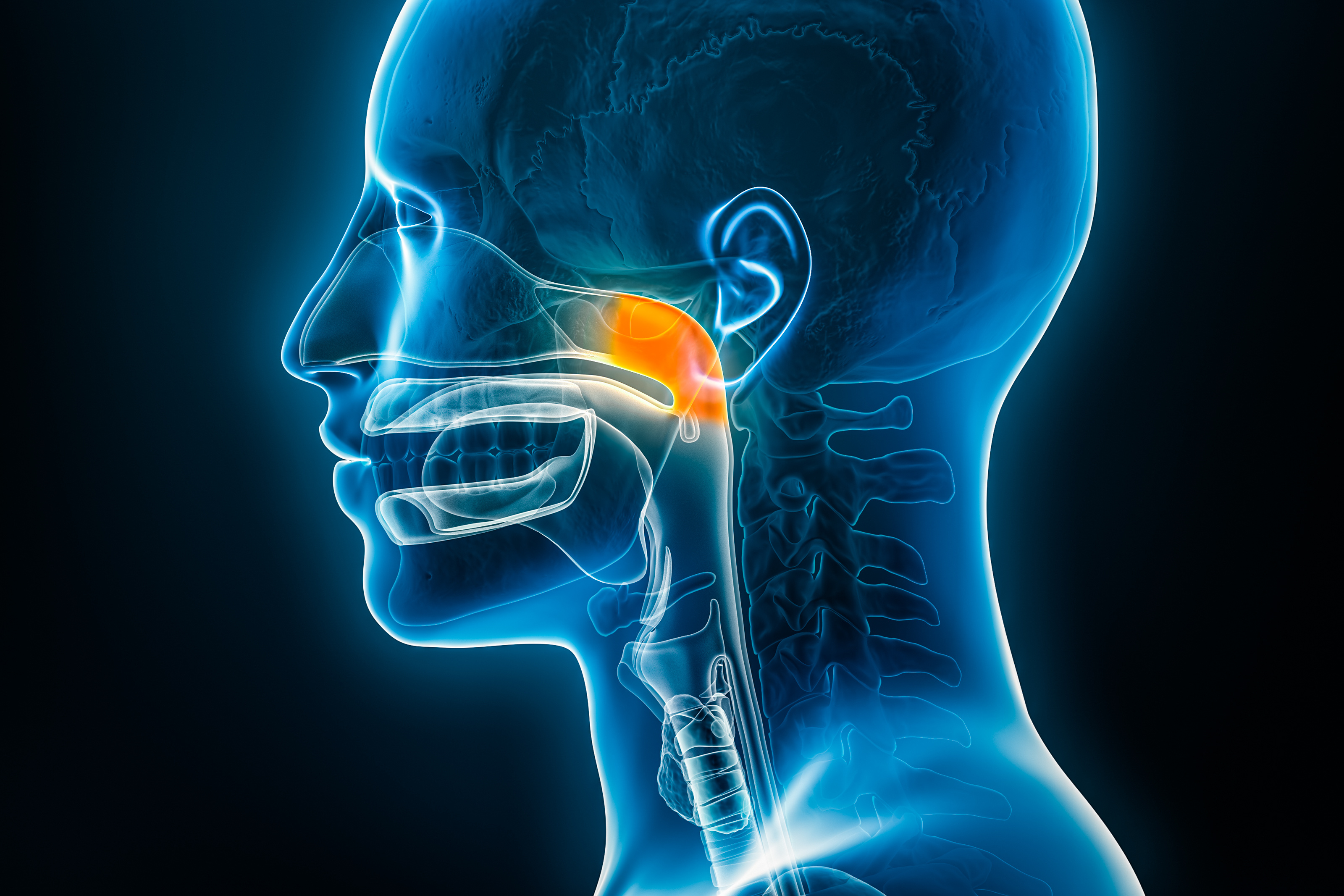 Nasopharyngeal Carcinoma Adding Sintilimab to Standard ...