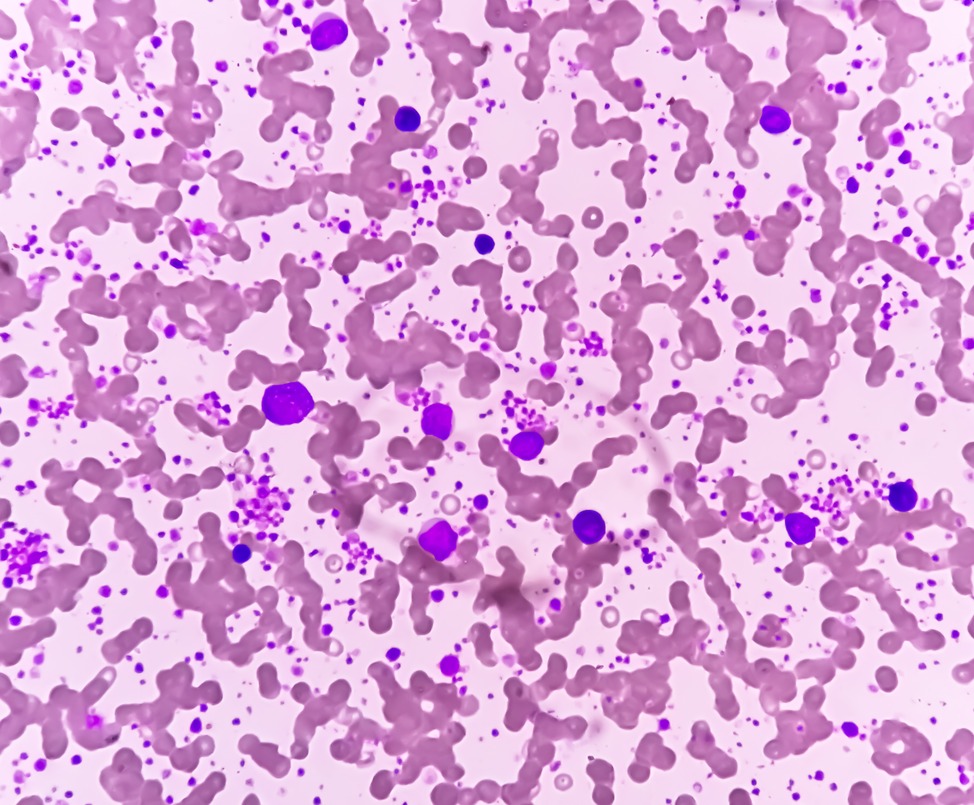 Novel Triplet Combination May Yield Positive Response in Patients With ...