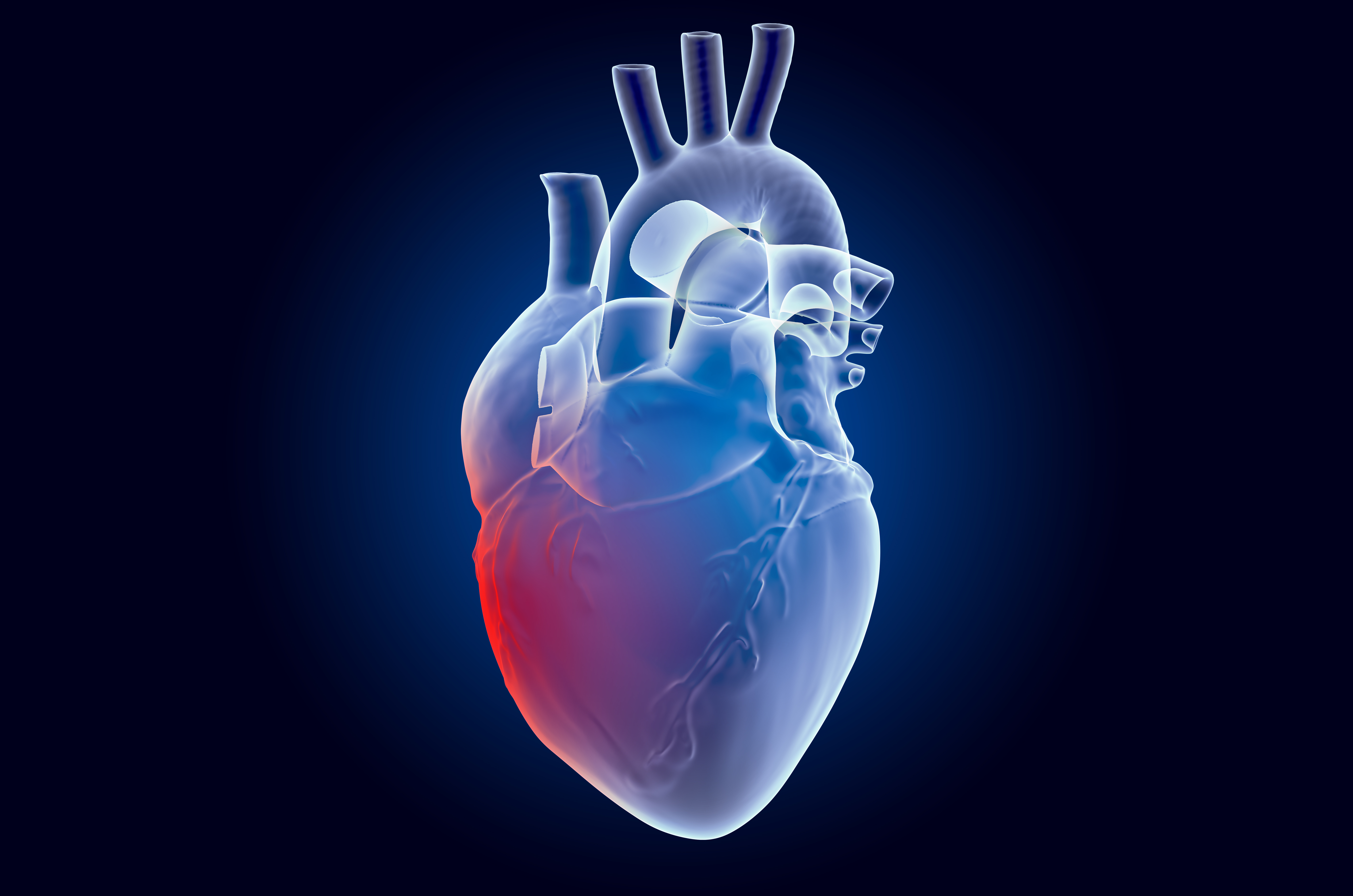 Early-Onset Myocarditis After Immunotherapy Linked to Higher Mortality Risk